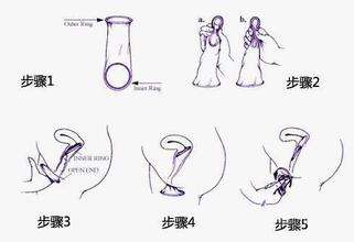 垃圾桶里的這半盒避孕套，可能是一次誤會——或者是危機
